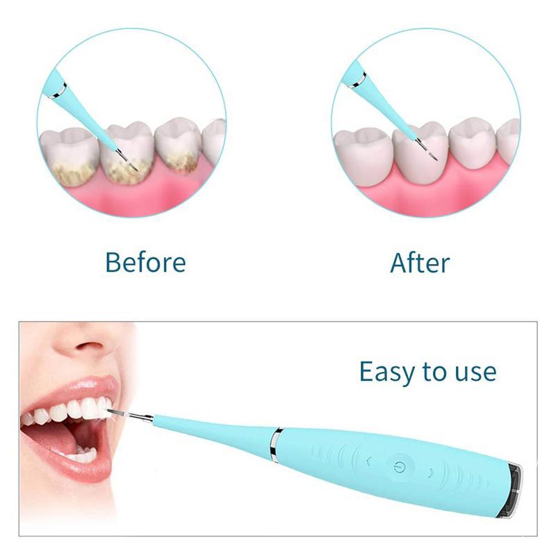 *Συσκευή Καθαρισμού Δοντιών με Υπερήχους DENTAL CALCULUS REMOVER A1550*